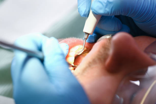 Best Walk-In Emergency Dental Services in District Heights, MD