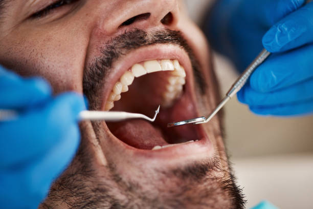 Best Urgent Dental Care for Toothaches in District Heights, MD