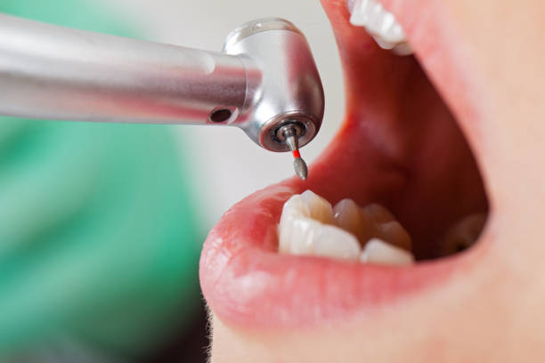 Best Emergency Treatment for Oral Infections in District Heights, MD